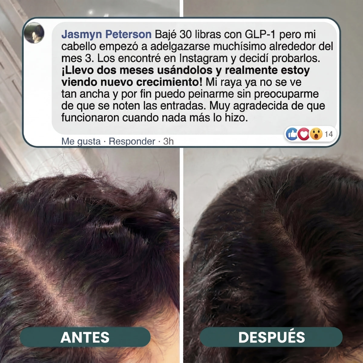 Gomitas Hair Revive